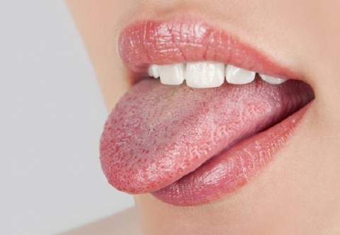 Đầu lưỡi nổi hột đỏ là biểu hiện của bệnh gì? Làm sao để chữa trị?