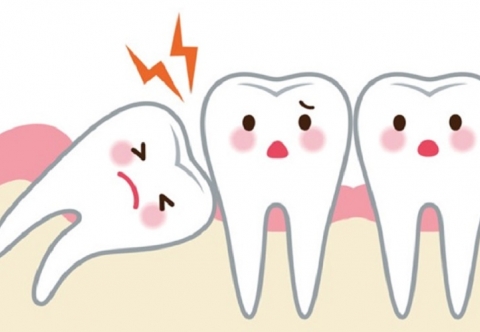 5 cách giảm đau khi mọc răng khôn hiệu quả ngay tại nhà
