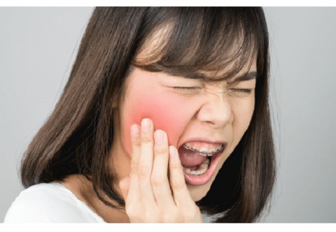 Nhức răng trong cùng hàm dưới điều trị như thế nào?