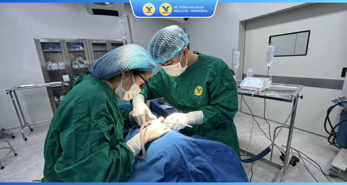 Bảng giá dịch vụ hàn trám răng thẩm mỹ