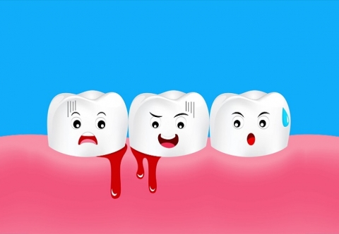 Nguyên nhân và cách khắc phục hiện tượng chảy máu chân răng