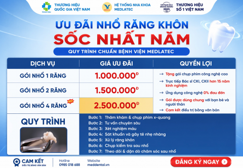 Ưu Đãi Nhổ Răng Khôn Sốc Nhất Năm: Chỉ Từ 1 Triệu Đồng – Trọn Gói 4 Răng Chỉ 2,5 Triệu Đồng Tại MedDental