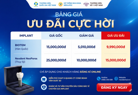 Ưu Đãi Cực Hời Implant Neodent NeoPoros Chỉ 15 Triệu – Tiết Kiệm Ngay 10 Triệu Đồng Tại MedDental