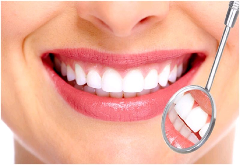 Bọc răng sứ thẩm mỹ
