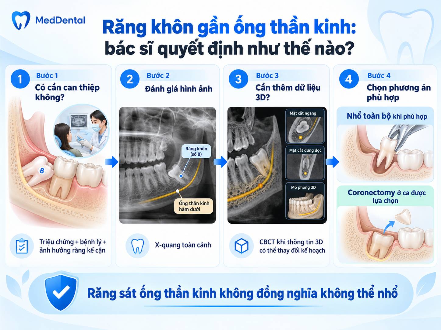 Sơ đồ quyết định khi răng khôn hàm dưới nằm sát ống thần kinh